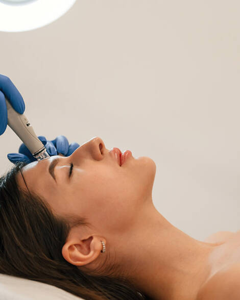 Microneedling Course